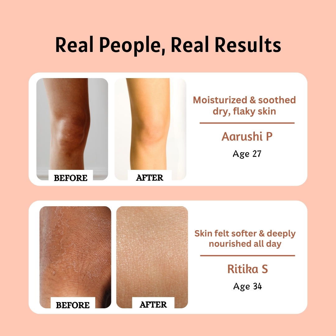 Natural  Ashwagandha Milk Malai Body Lotion