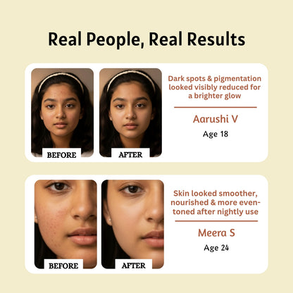 Kumkumadi Face Oil (PM)